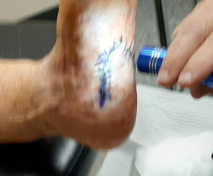 foot-2
