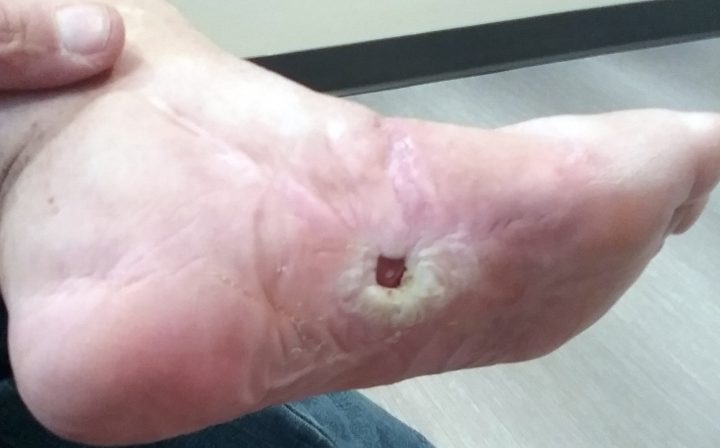 foot-may-2019